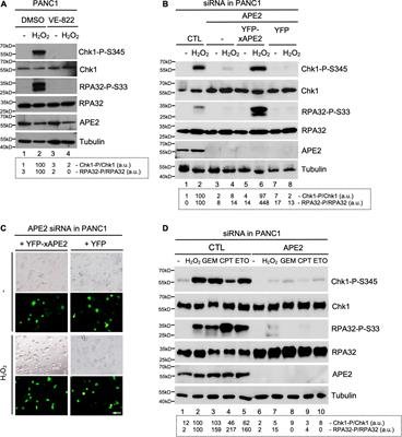 APE2 Is a General Regulator of the ATR-Chk1 DNA Damage Response Pathway to Maintain Genome Integrity in <mark class="highlighted">Pancreatic Cancer Cells</mark>